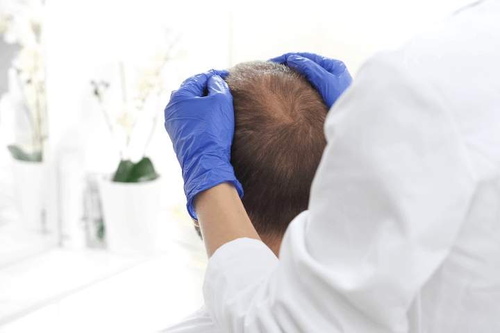 Head Massage Bosley Hair Restoration