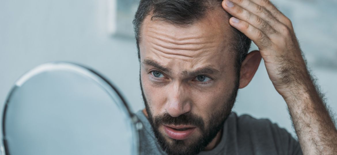 man noticing he's losing hair