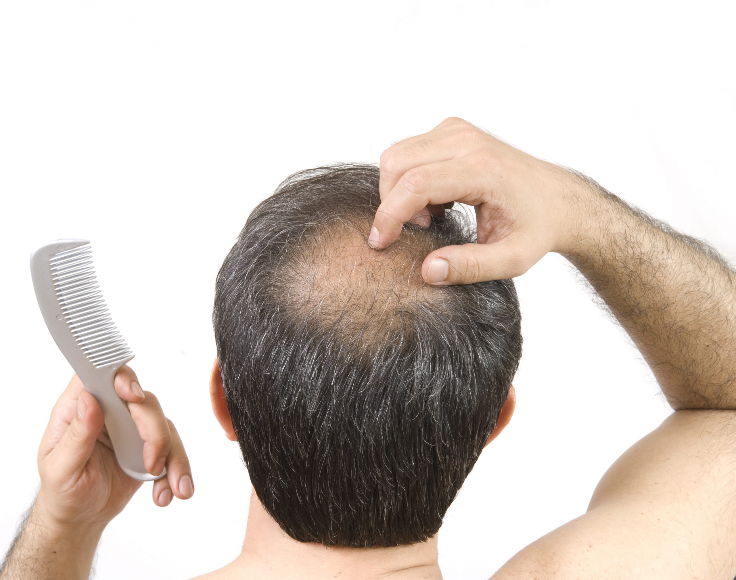 man itching his bald spot while holding a comb