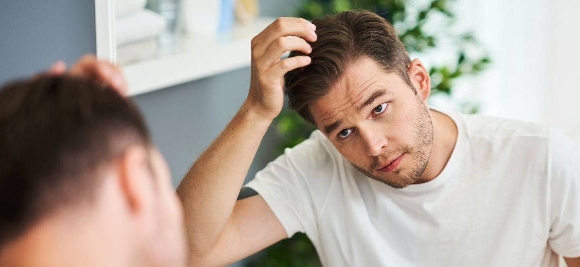 man checking for hair loss