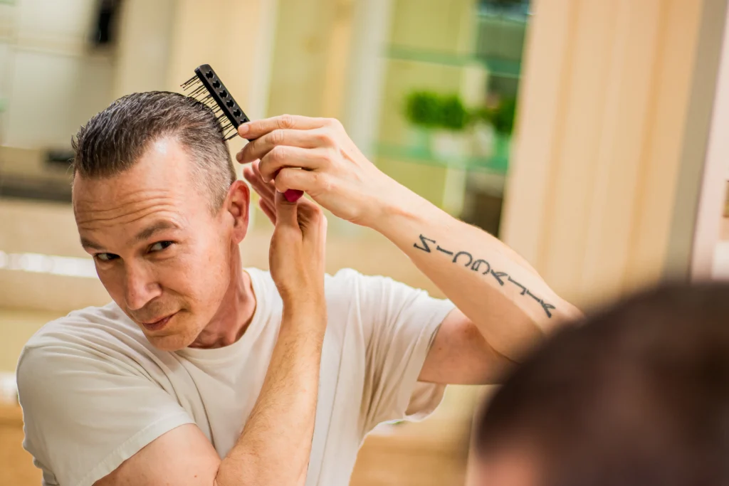What Is Hair Miniaturization How to Tell If It&rsquo;s Happening to You