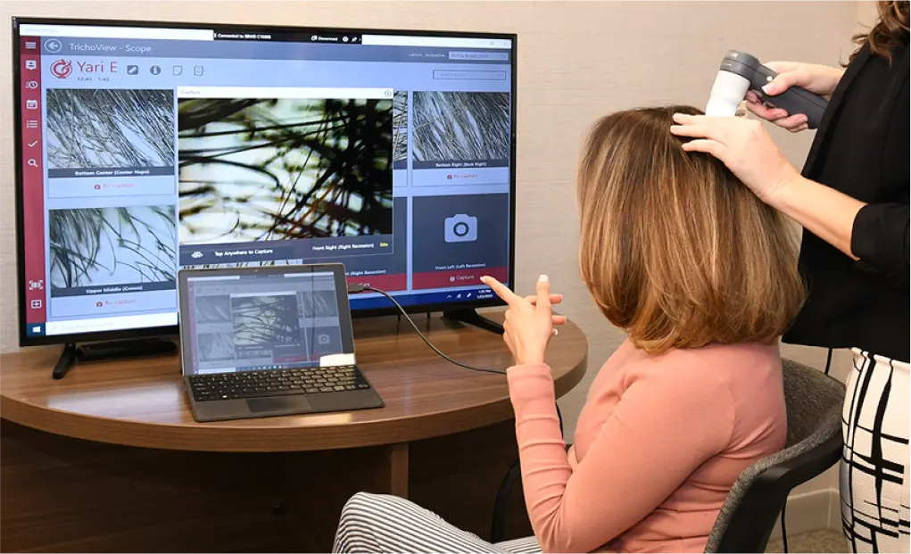 HairClub - TrichoView - a woman at a HairClub Center for her initial consultation - she is talking to a HairClub Hair Loss Specialist and viewing her TrichoView results on a monitor.