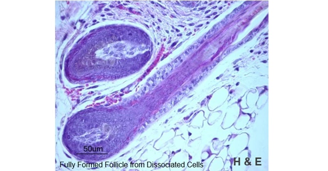 Fully Formed Follicle from Dissociated Cells -- H & E