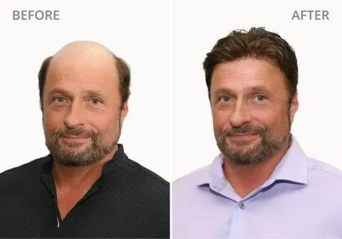 Jeff's Before and After