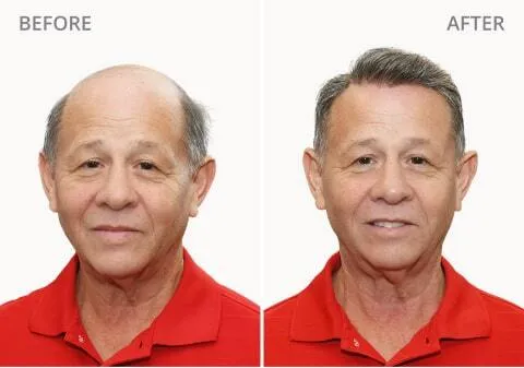 Keith M Before and After