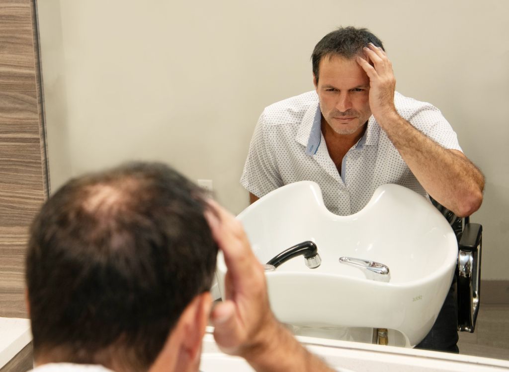 Man with Thinning Hair
