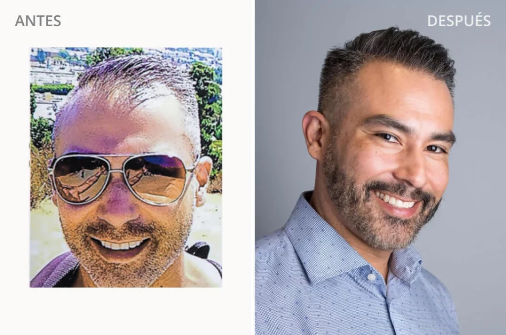 Edgar S. Before and After