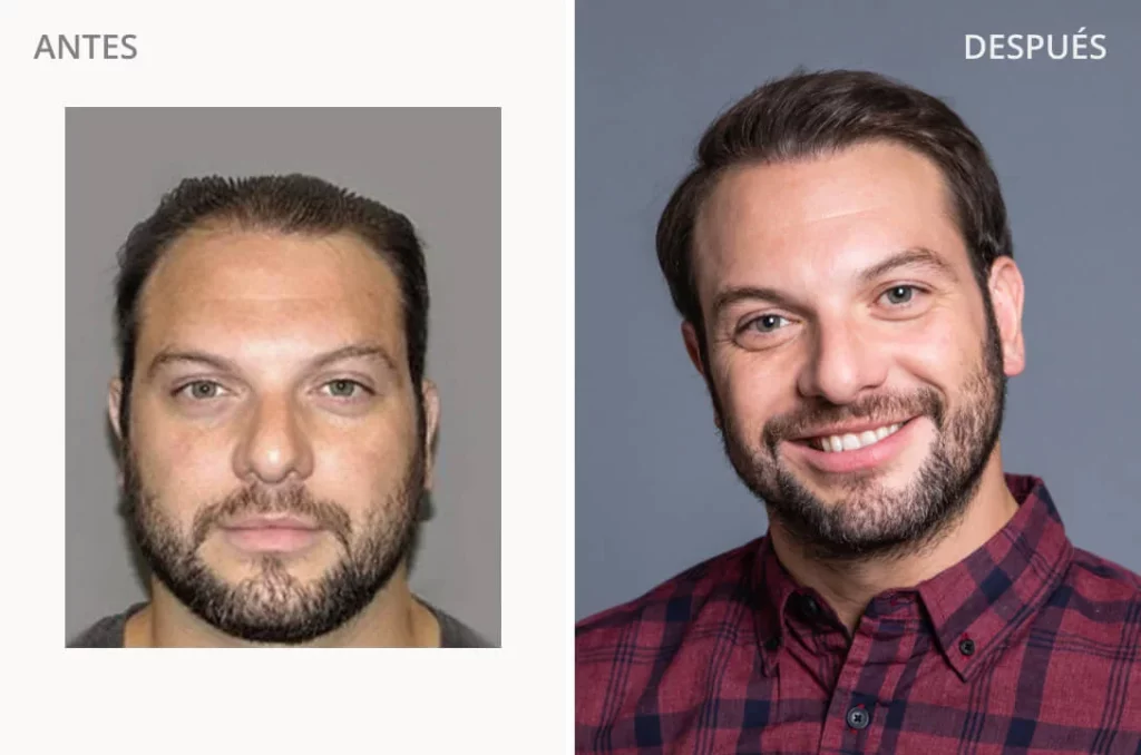Ryan L. - Before and After