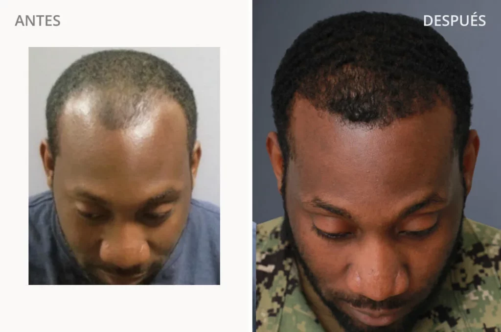 Raynard M. - Before and After