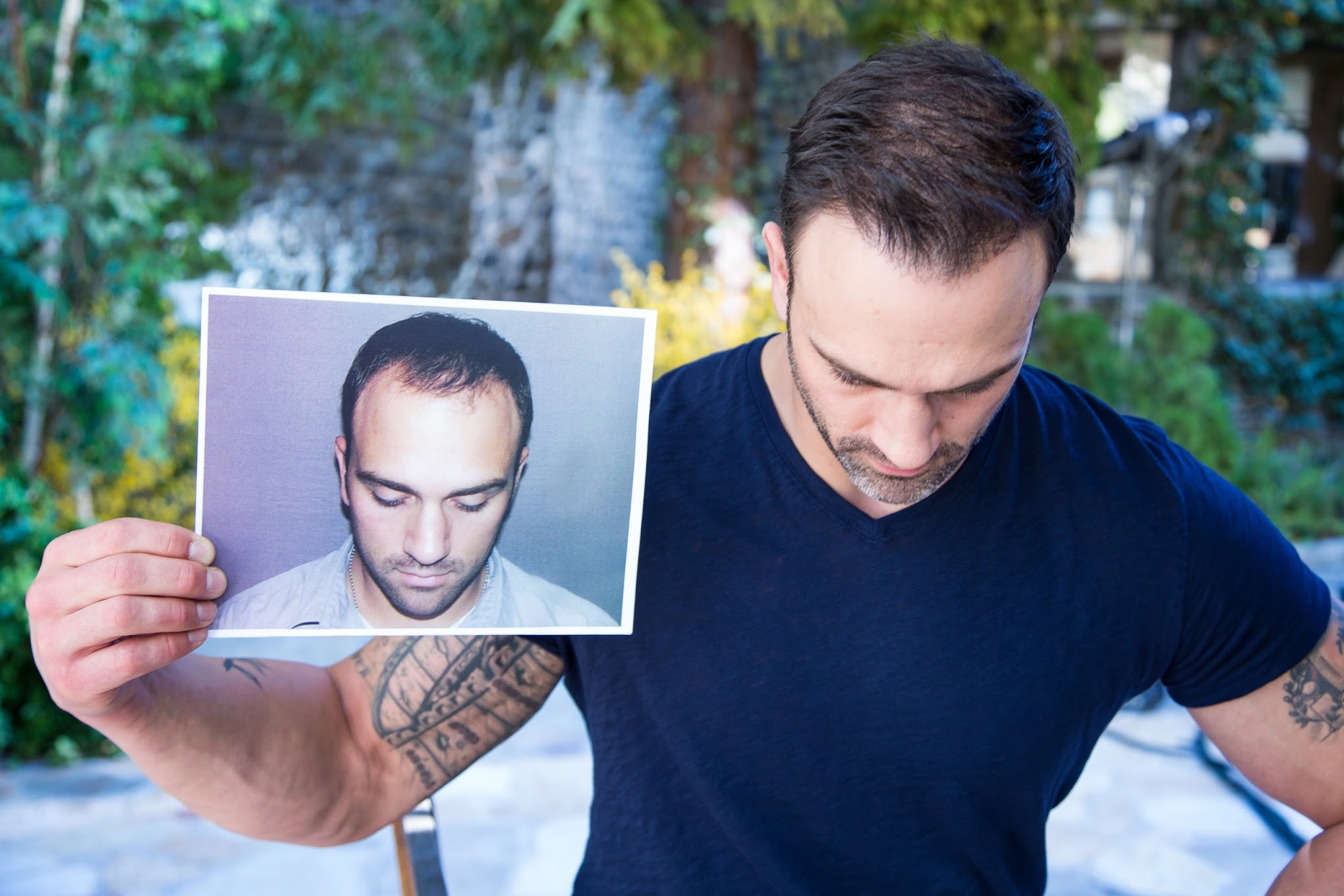 Bosley patient holding a before photograph