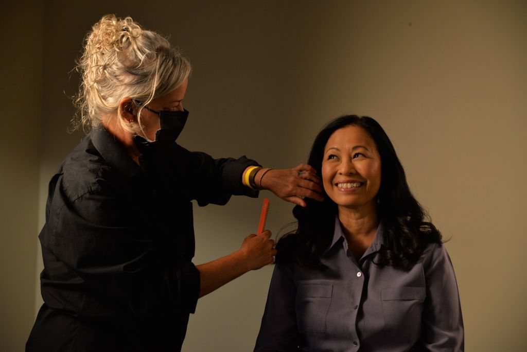 Hair Loss in Women