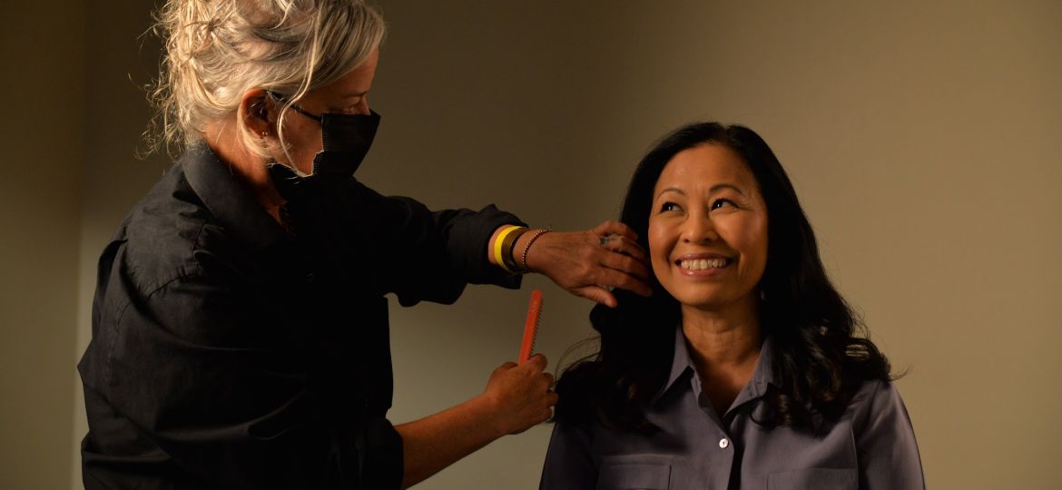 Hair Loss in Women