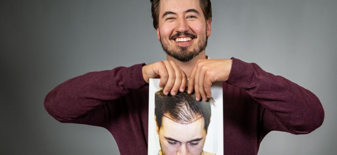 hair-growth-for-men