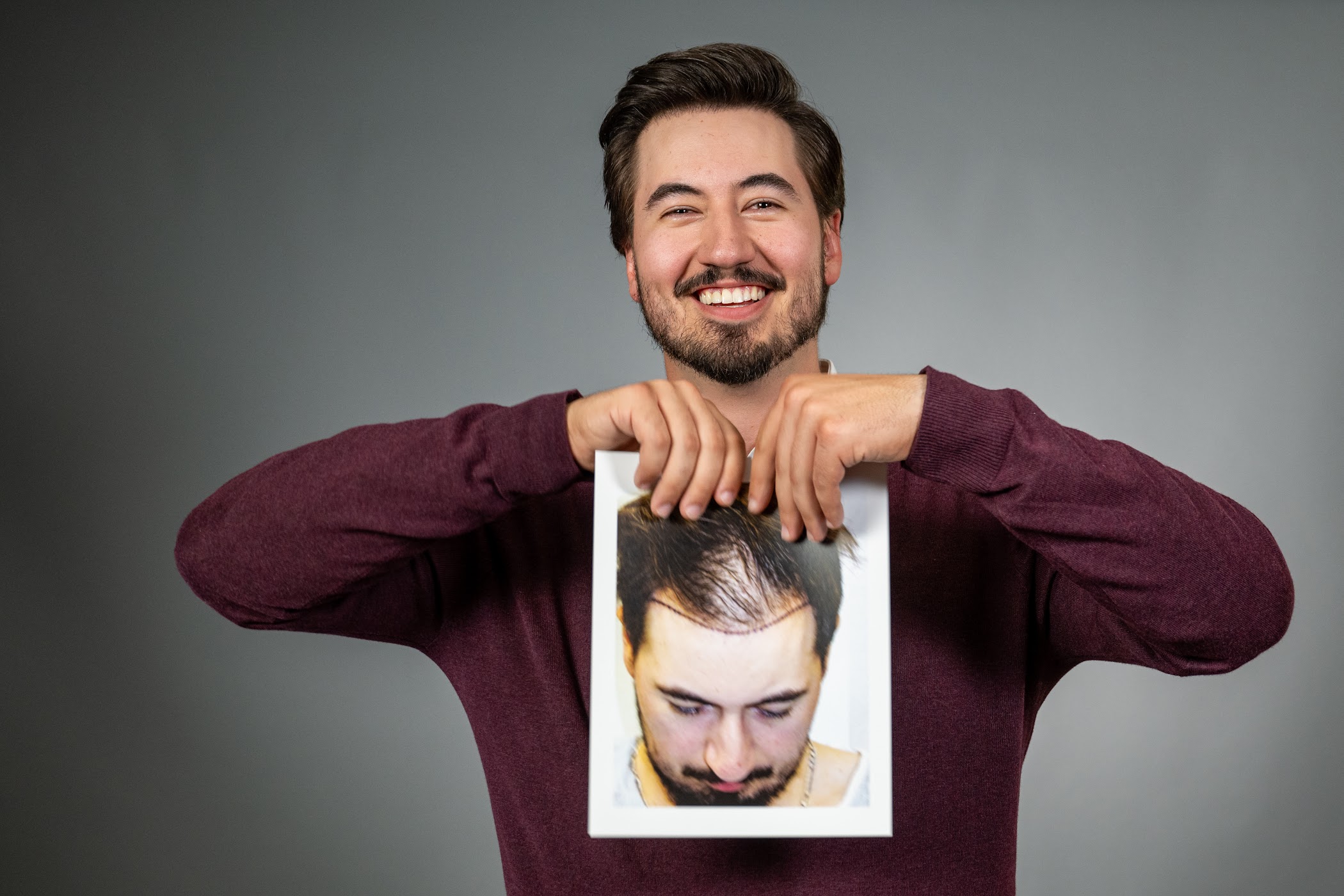 hair-growth-for-men