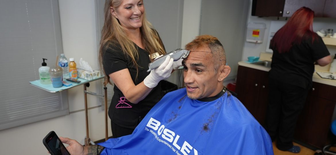 best-hair-loss-treatments-for-men-near-you