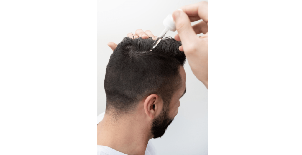 best-over-the-counter-hair-loss-treatments-for-men