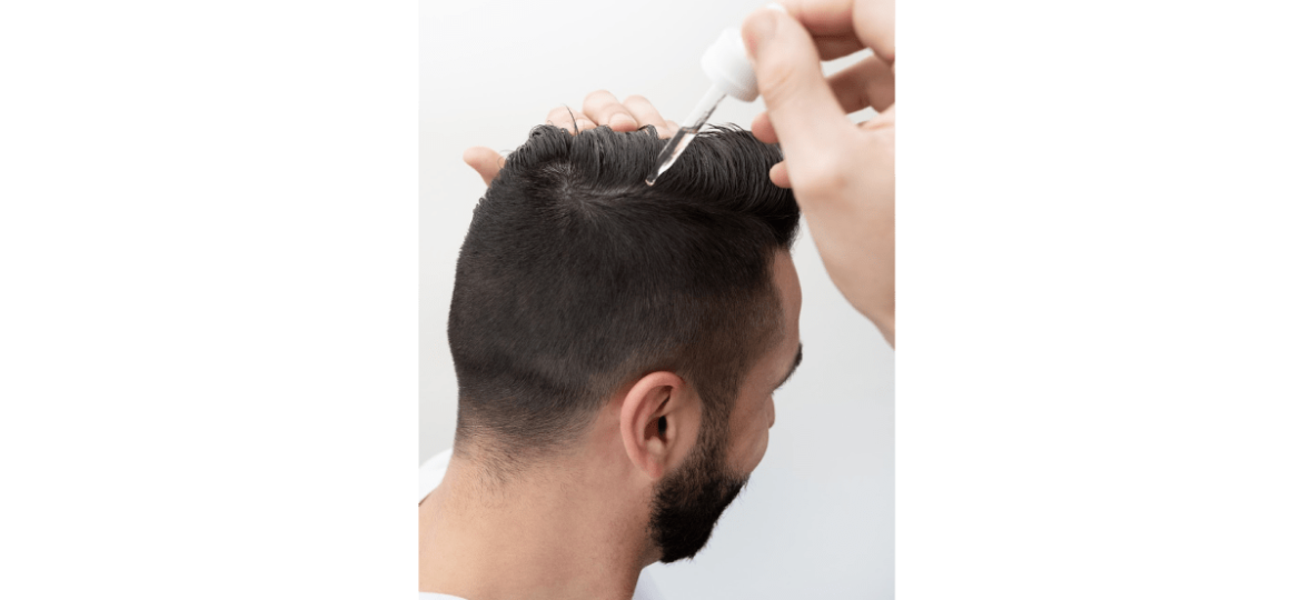 best-over-the-counter-hair-loss-treatments-for-men