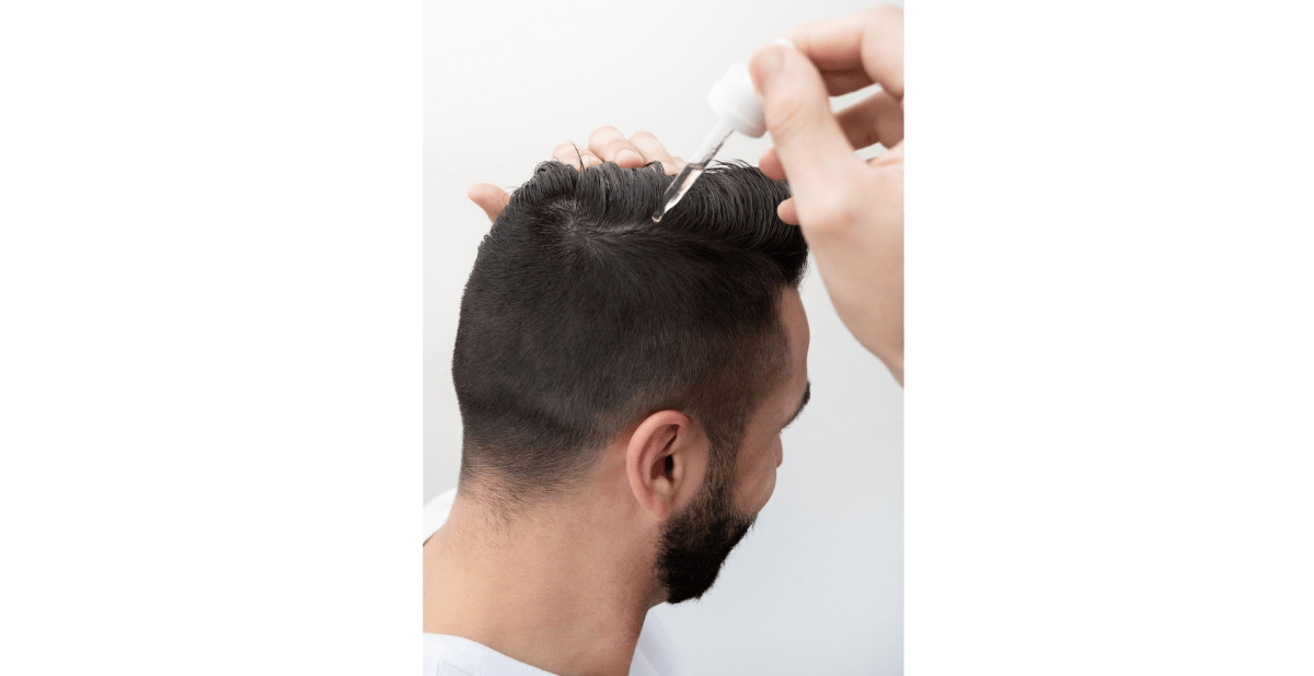 best-over-the-counter-hair-loss-treatments-for-men