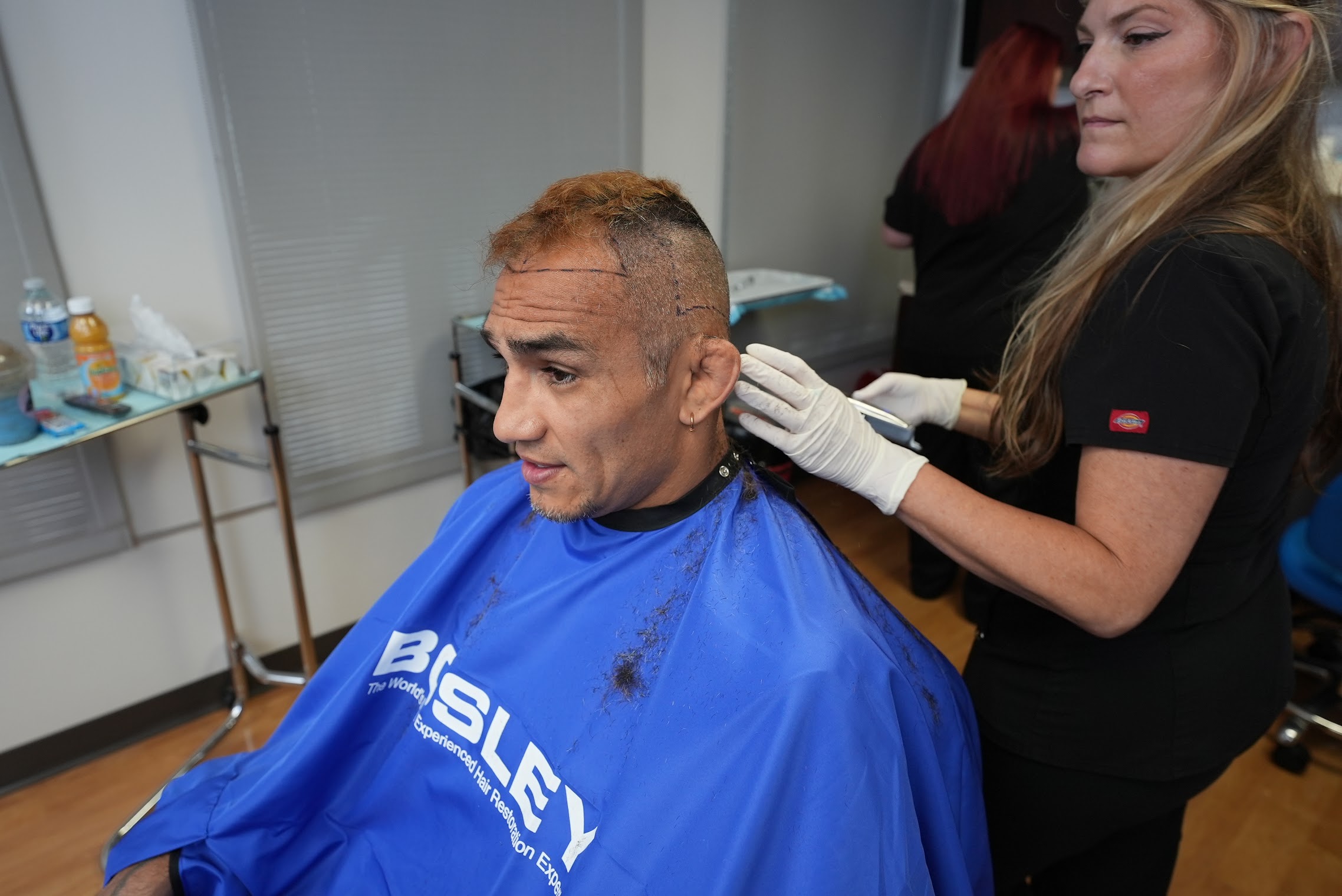 Clinical hair restoration procedure focusing on Hair Follicle Health, showing a specialist preparing the scalp to support healthy follicles and long-term hair growth.