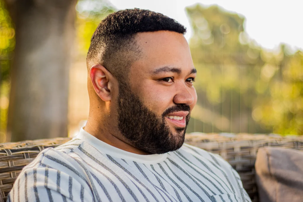 Balding? Here are the Non-Surgical Hair Solutions Everyone’s Talking About