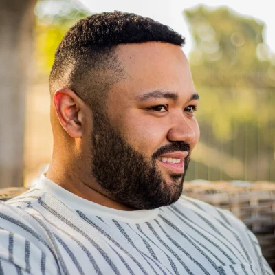 Balding? Here are the Non-Surgical Hair Solutions Everyone’s Talking About