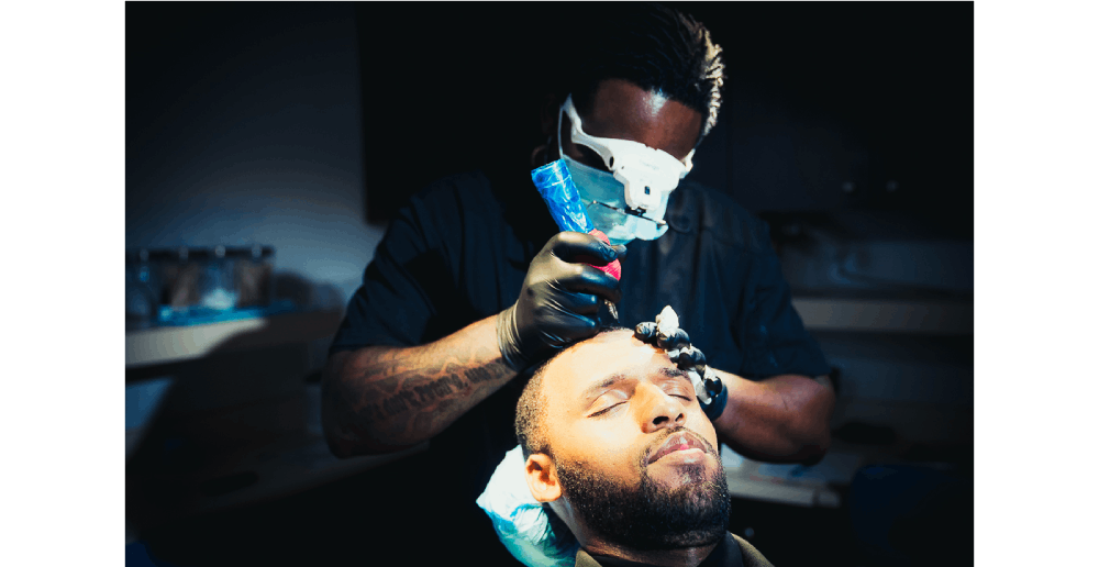 Scalp Micropigmentation (SMP) procedure performed by a specialist to create the appearance of fuller hair