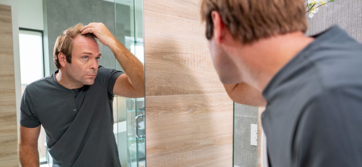 Man examining thinning hairline in mirror related to DHT hair loss