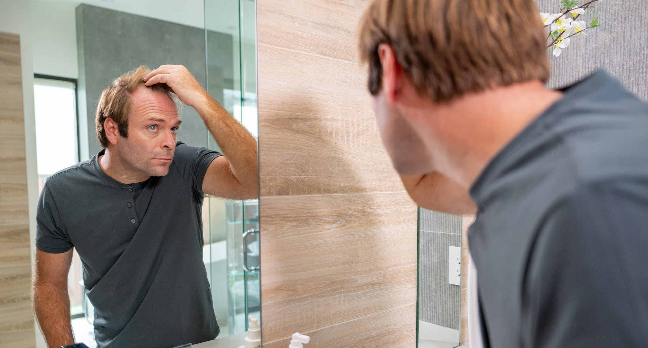 Man examining thinning hairline in mirror related to DHT hair loss