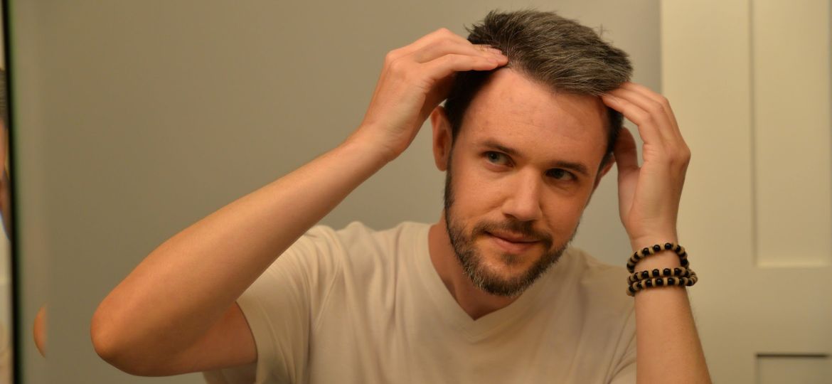 Man examining hair loss in mirror before seeking Hair Fall Treatment Near Me consultation