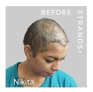 nitika