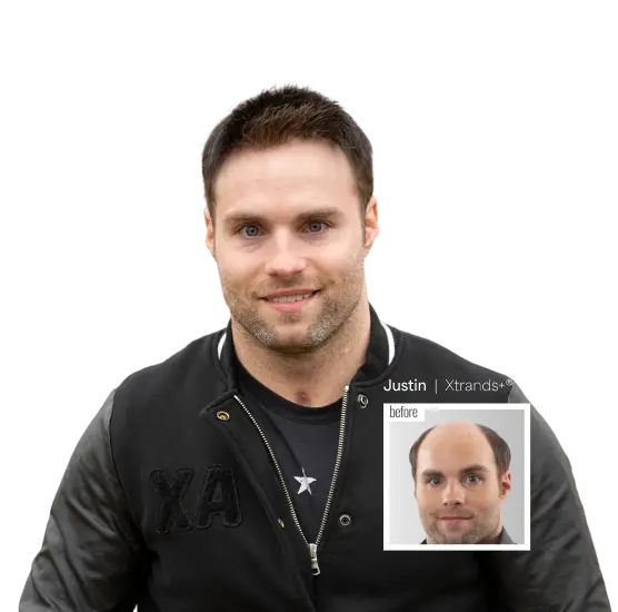 Custom Hair System&nbsp;