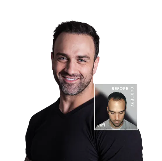 Hair Systems by Hairstyle