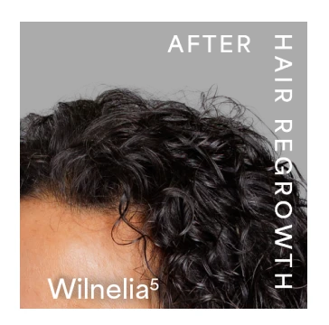 Wilnelia