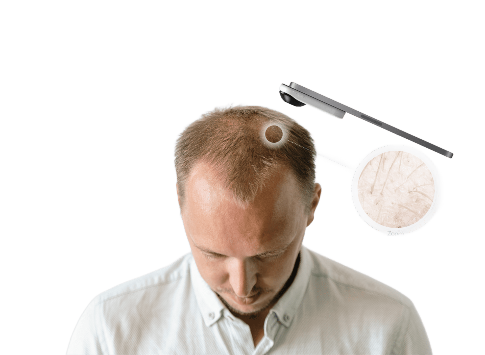 Hair and scalp analysis