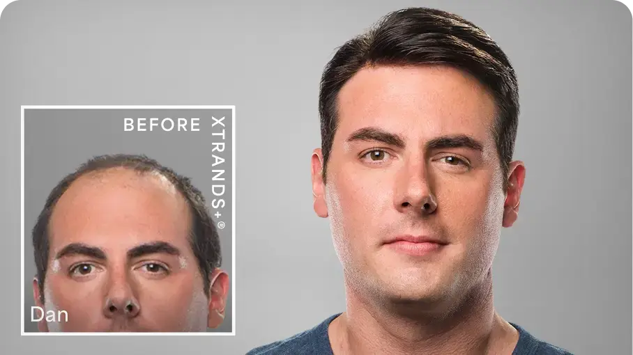 dan-before-image