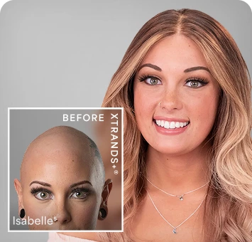 ssabelle-before-image