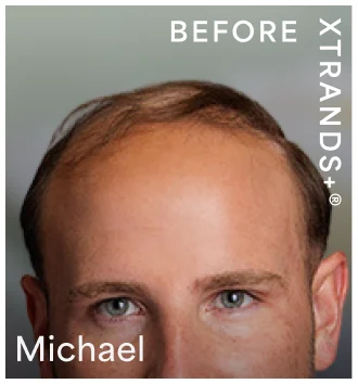 michael-before
