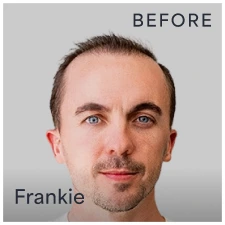 Frankie