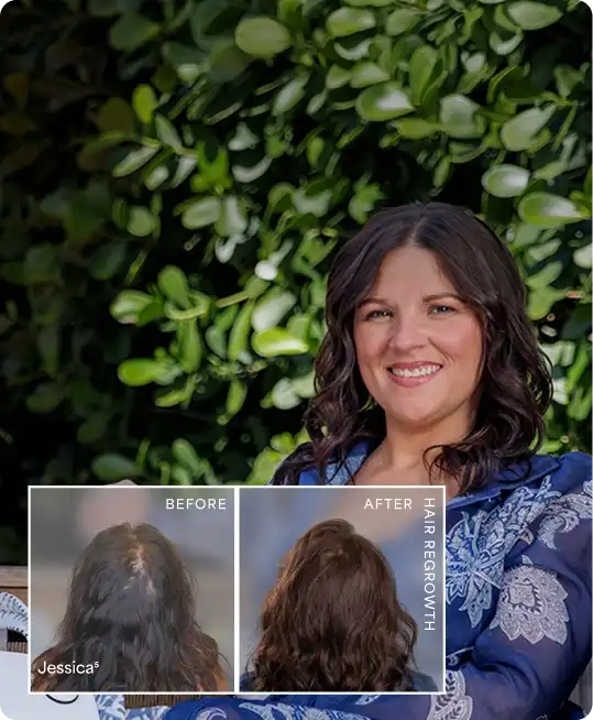 For Every Stage of Hair Loss