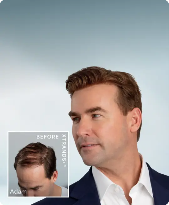 Prevention Regrowth