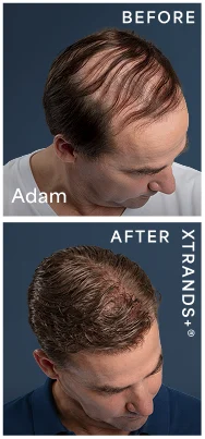 before after