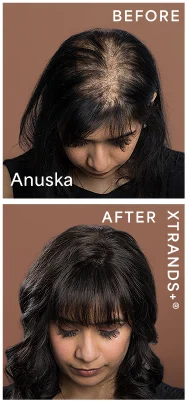 before after