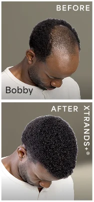 before after