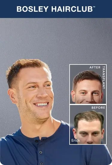 Bosley Hairclub