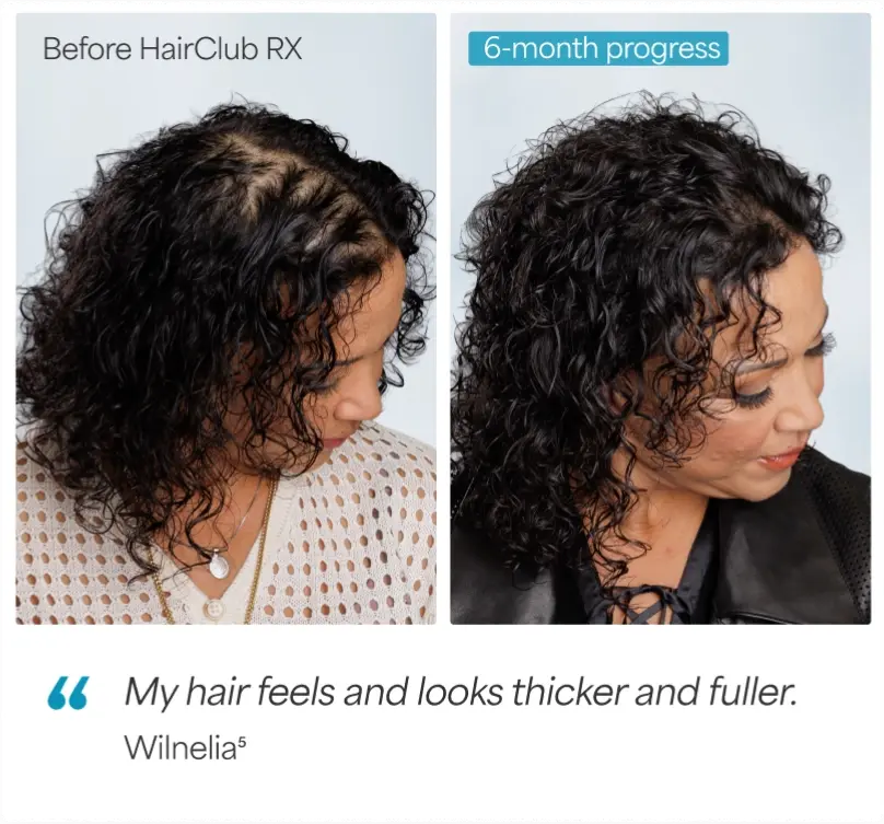 model before