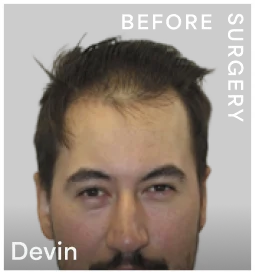 devin