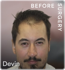 Devin