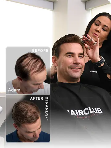 Before-After-Hair-Restoration-Mobile