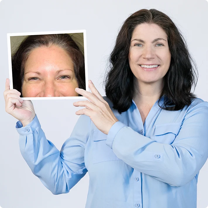 Benefits of an Eyebrow Transplant