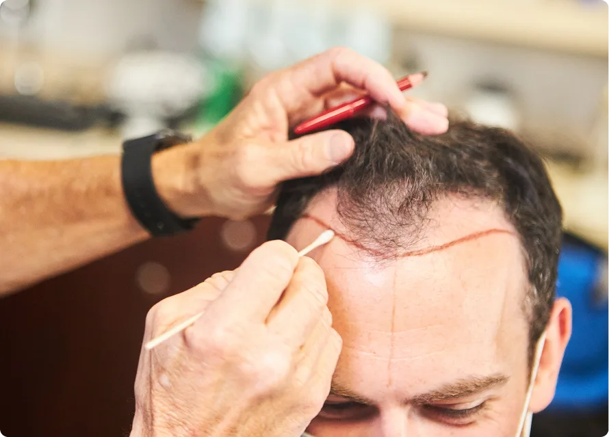 Bosley HairClub Repairs